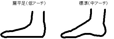 アーチが弱くなる